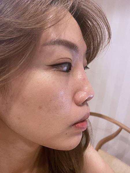 台中醫美診所-潘朵拉微整形