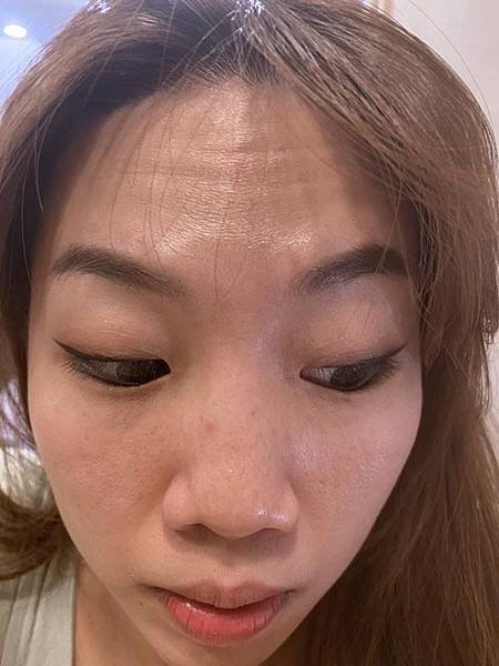 台中醫美診所-潘朵拉微整形