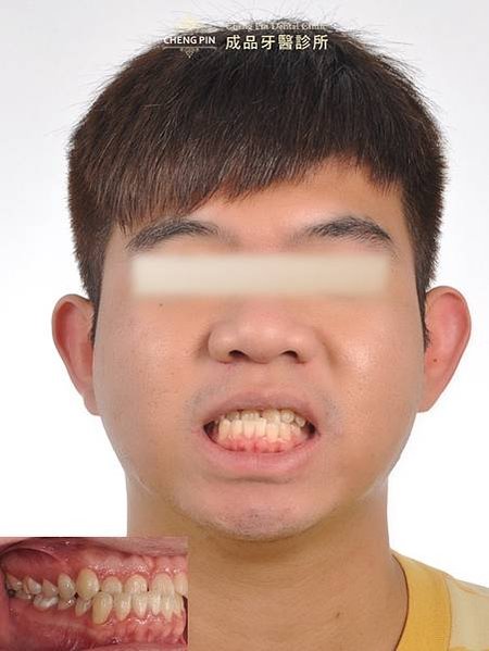 美肌_03