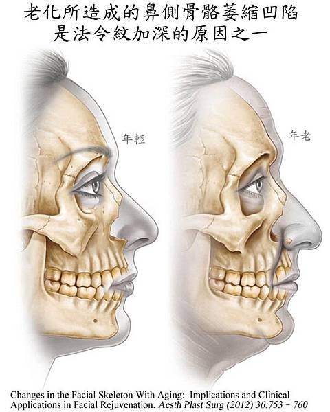 FacialBoneAging2