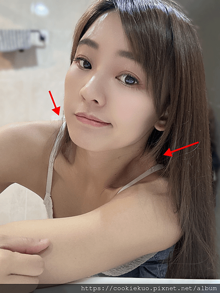台北＜琢月診所＞肉毒瘦肩針，徹底擺脫媽媽肩，讓我回歸小姐姿態