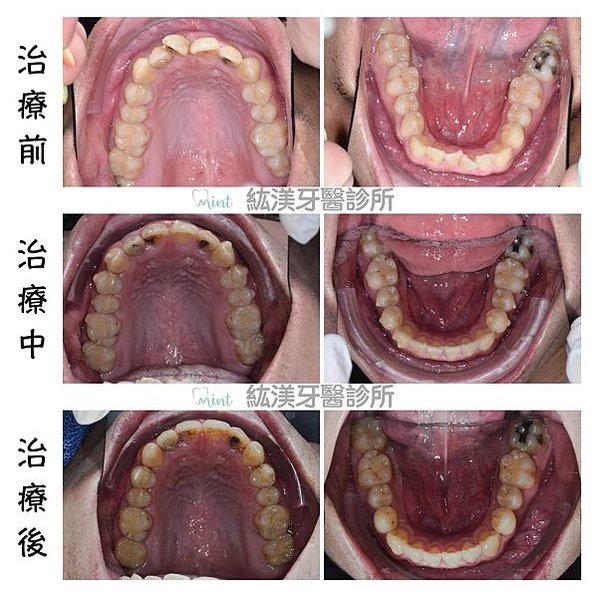 龔信嘉_上下顎