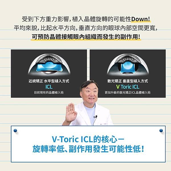 韓國眼科｜高度散光👀交給垂直型ICL植入式微型鏡片V-Tor