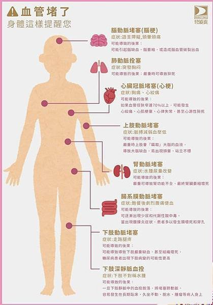 血管堵了 身體這樣提醒你