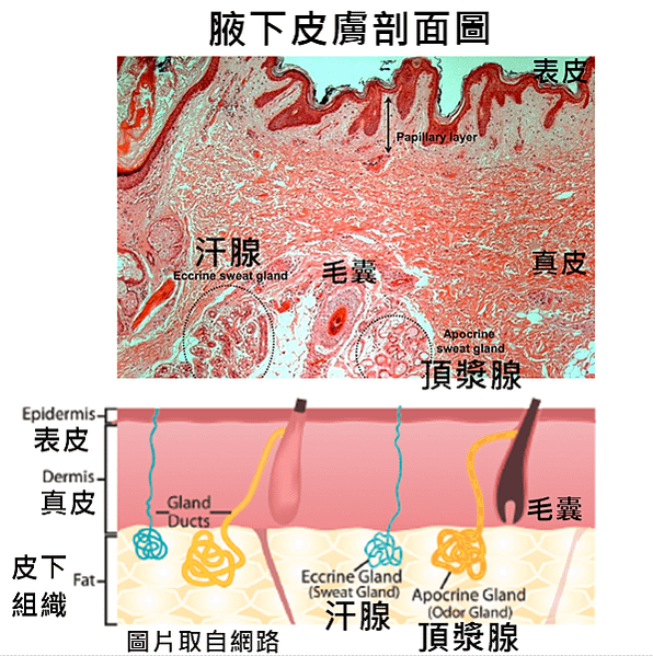 ❤狐臭手術  旋轉刀狐臭手術，從傳統而進化