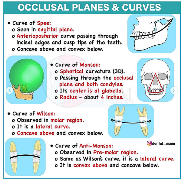 @齒顎矯正每日一說~~0154 curve of Spee(