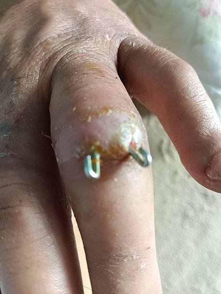 甘霖慈善積德會案例分享文（113年12月）