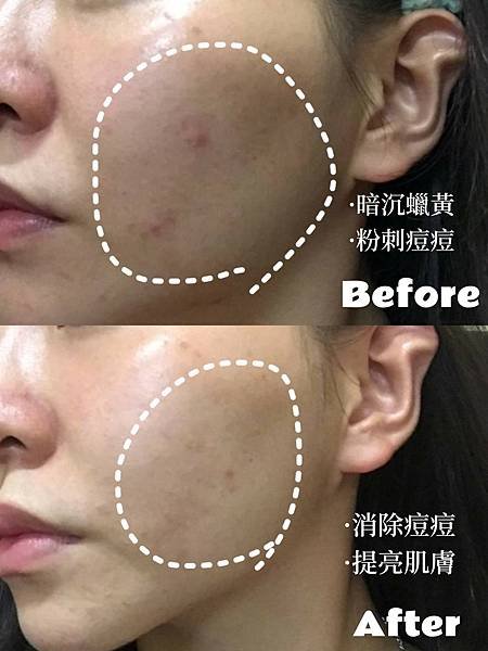 LINE_ALBUM_試用照、對比照_240125_1.jpg