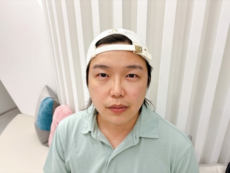 [保養] 愛爾麗診所 ♥ HiPRO-S龍捲風音波拉提 ♥ 