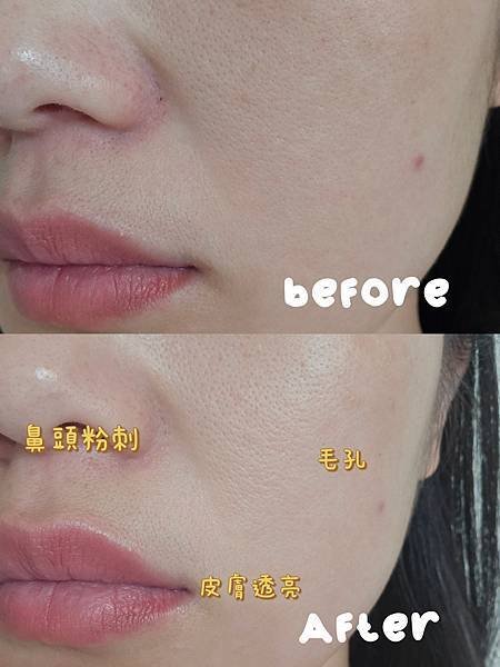 【LOYE樂妍】早C晚A｜維C酵母精華乳｜維A角鯊精華油｜M