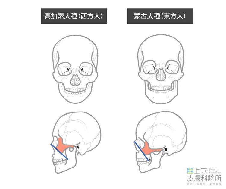 洢蓮絲推薦醫生洢蓮絲維持多久洢蓮絲術後腫脹洢蓮絲注意事項舒顏萃和洢蓮絲上立皮膚科洢蓮絲電波拉皮洢蓮絲凹凸不平自體脂肪 (2).jpg