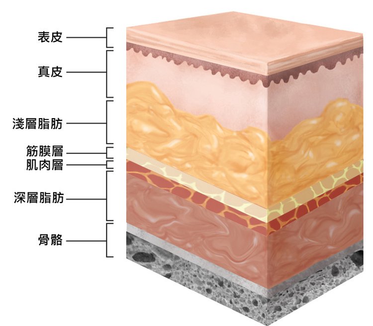 液態拉皮上立提舒顏萃sculptra3D聚左旋乳酸洢蓮絲ellanse聚己內酯PCL台北醫美推薦抗老林上立醫師上立皮膚科診所 (6).jpg