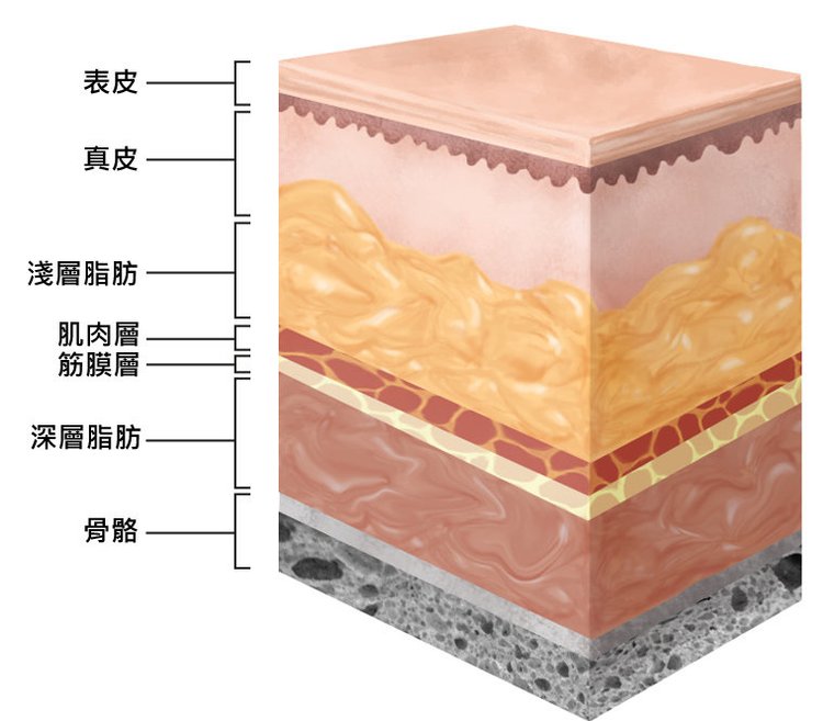 埋線拉皮費用臉部埋線價格效果埋線拉提副作用埋線拉提推薦臉部價格4D埋線拉皮埋線拉皮推薦埋線林上立醫師推薦醫師液態拉皮上立提立提線少女線立提少女線3.jpg