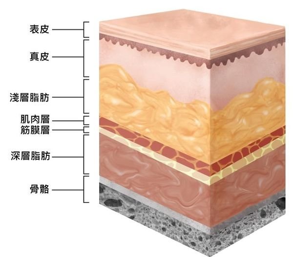 液態拉皮上立提舒顏萃sculptra3D聚左旋乳酸塑然雅童顏針淚溝洢蓮絲ellanse聚己酯PCL依戀詩易麗適少女針奇蹟針03.jpg