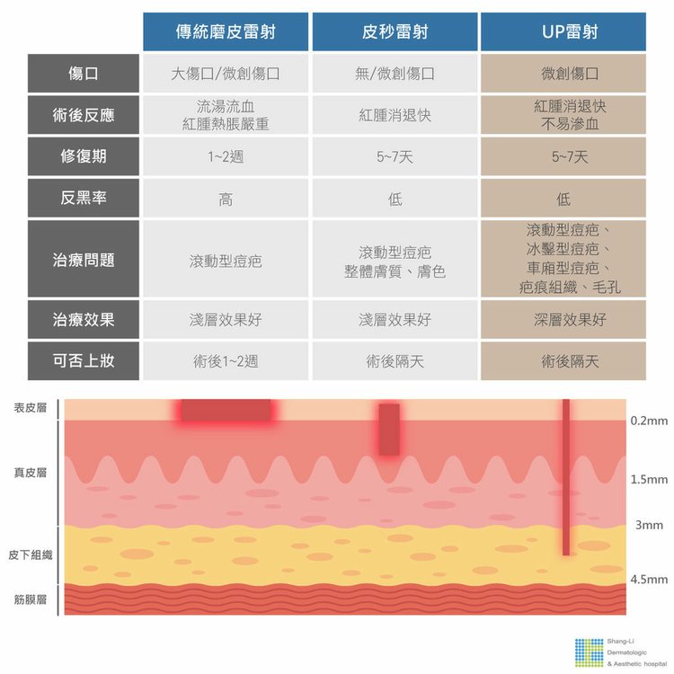 UP雷射痘疤雷射推薦林上立醫師蜂巢皮秒雷射.jpg