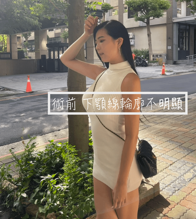 【台北醫美推薦】佳思優整形醫美診所│New Doublo新倍