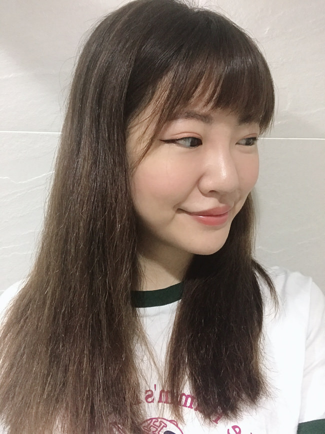 玻尿酸鼻子變寬