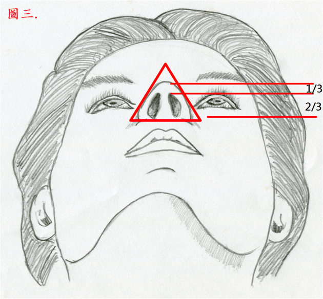 內開隆鼻