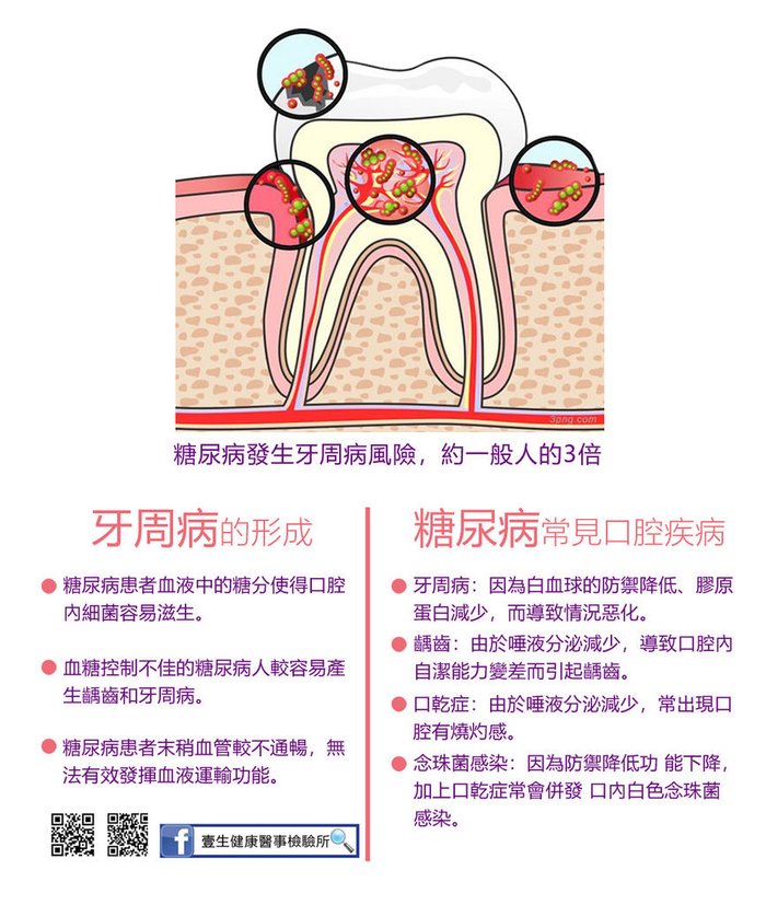 牙周病形成.jpg