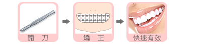 高雄正顎1tiny