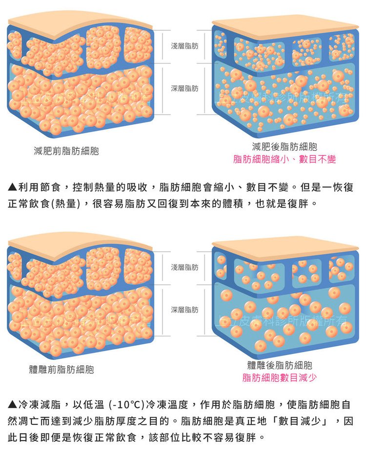 MICOOL-S冷凍溶脂效果冷凍溶脂價錢冷凍減脂心得冷凍溶脂推薦冷凍溶脂ptt冷凍溶脂原理冷凍溶脂術後瘦肚子的方法快速瘦肚子運動瘦肚子按摩快速瘦小腹運動瘦肚子飲食瘦肚子09.jpg