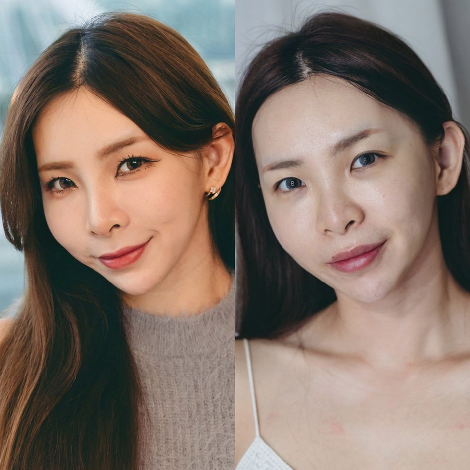 變身濃顏系美人 偷偷變漂亮秘密-美麗風尚醫學美容診所 無痕鼻