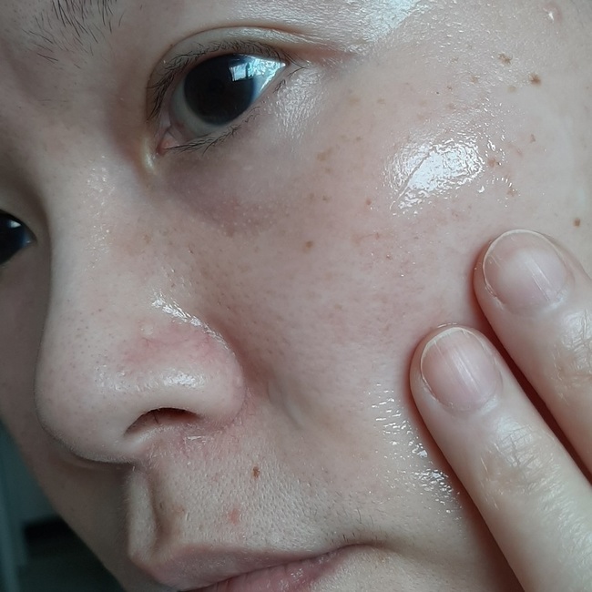 ＯＫ一般就全臉按壓３下即可