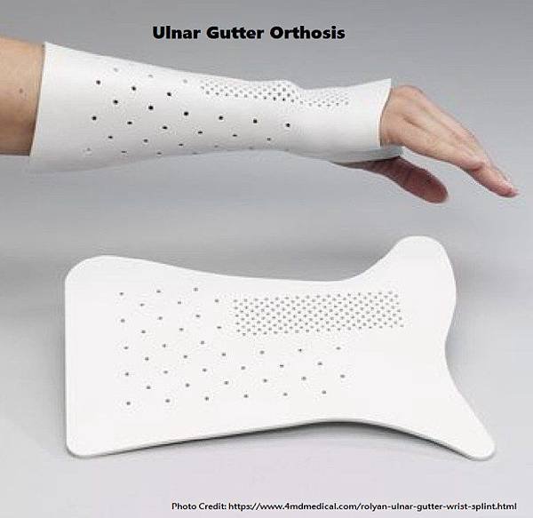 xrolyan-ulnar-gutter-wrist-splint-6da.jpg.pagespeed.ic_.vnLmp4Go6b.jpg