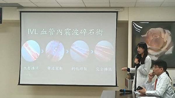 IVL血管內震波碎石術3大優勢 改善患者血管嚴重鈣化問題