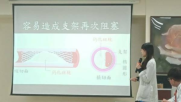 IVL血管內震波碎石術3大優勢 改善患者血管嚴重鈣化問題