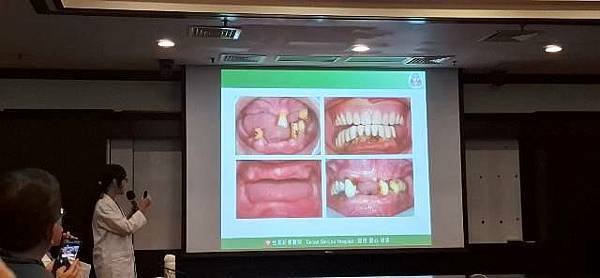 長輩能吃才是福 享受人生由齒開始