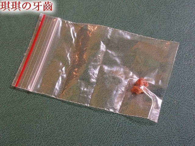 066琪琪拔牙記 (26).jpg