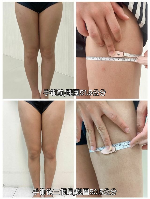 佳思優豐胸 (15).jpg