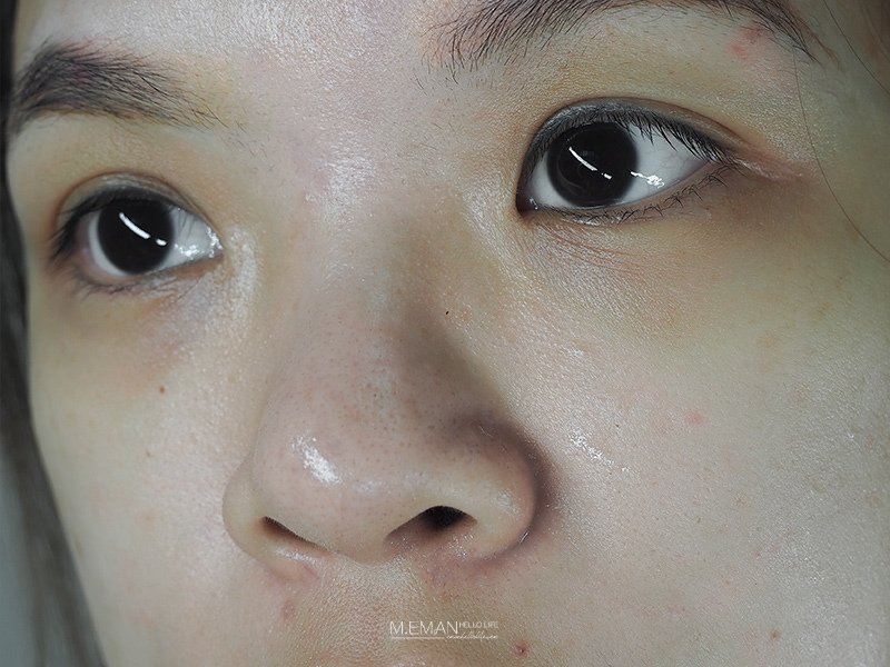 NU+derma_27.jpg