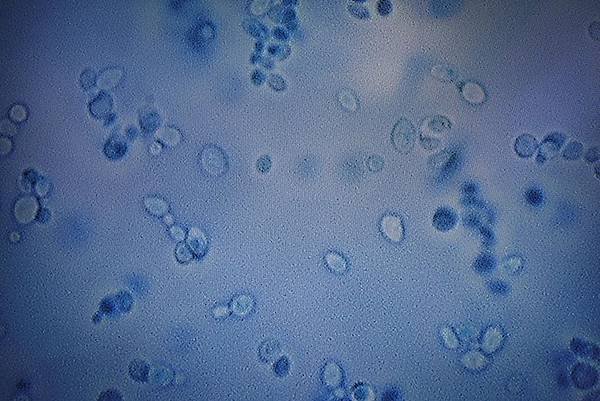 dw-fungus-candidaauris2-190407.jpg