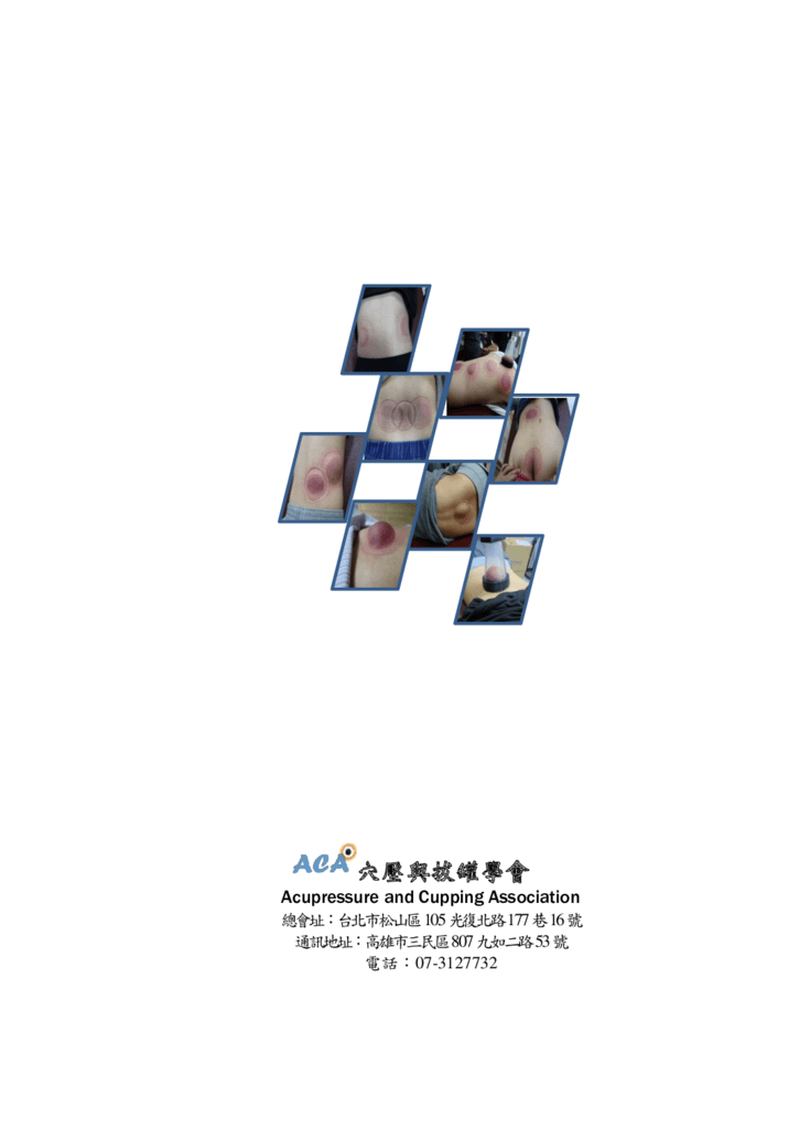 第三期改第30頁Journal of Neo-Medicine Vol 2 No 2 20191003_p110.png