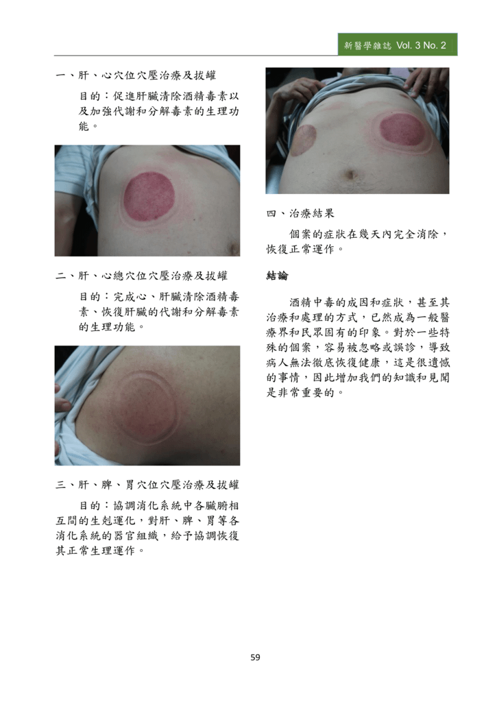 新醫學雜誌第5期PDF版_061.png