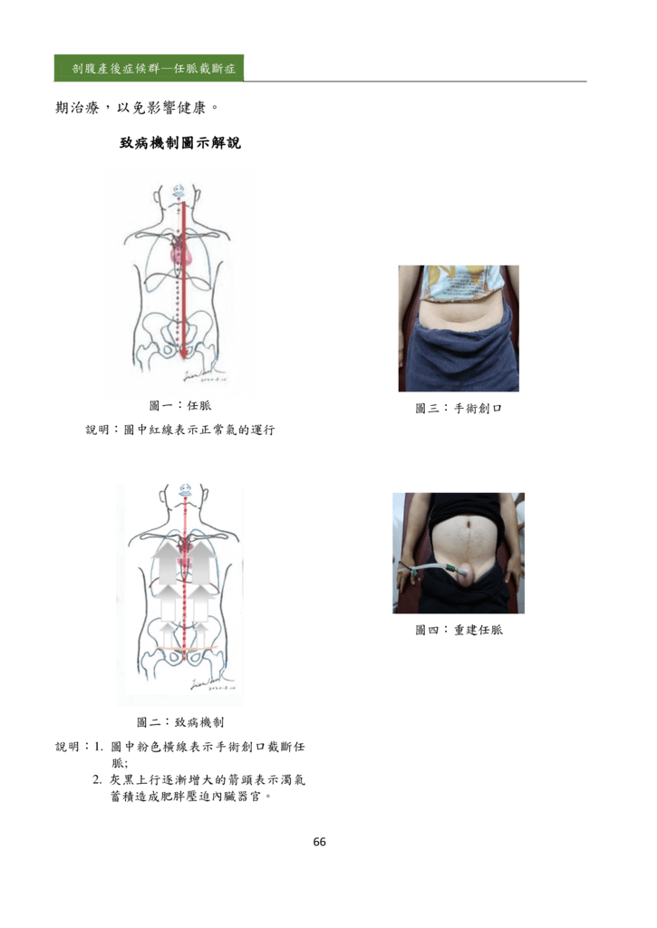新醫學雜誌第5期PDF版_068.png