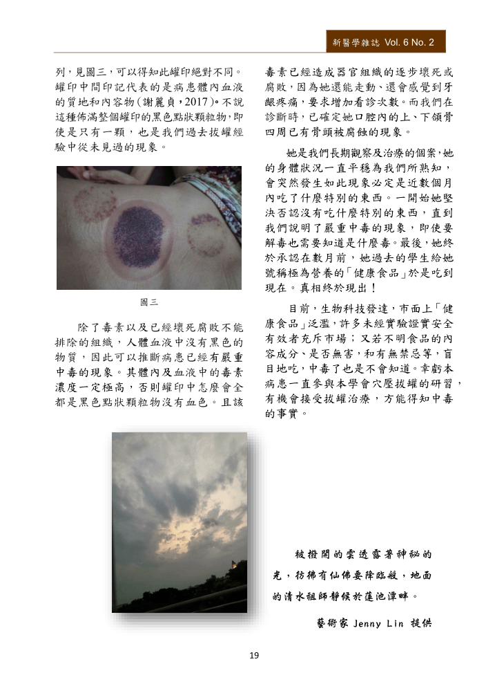 新醫學雜誌第十一期全文PNG檔(適合以手機閱讀)