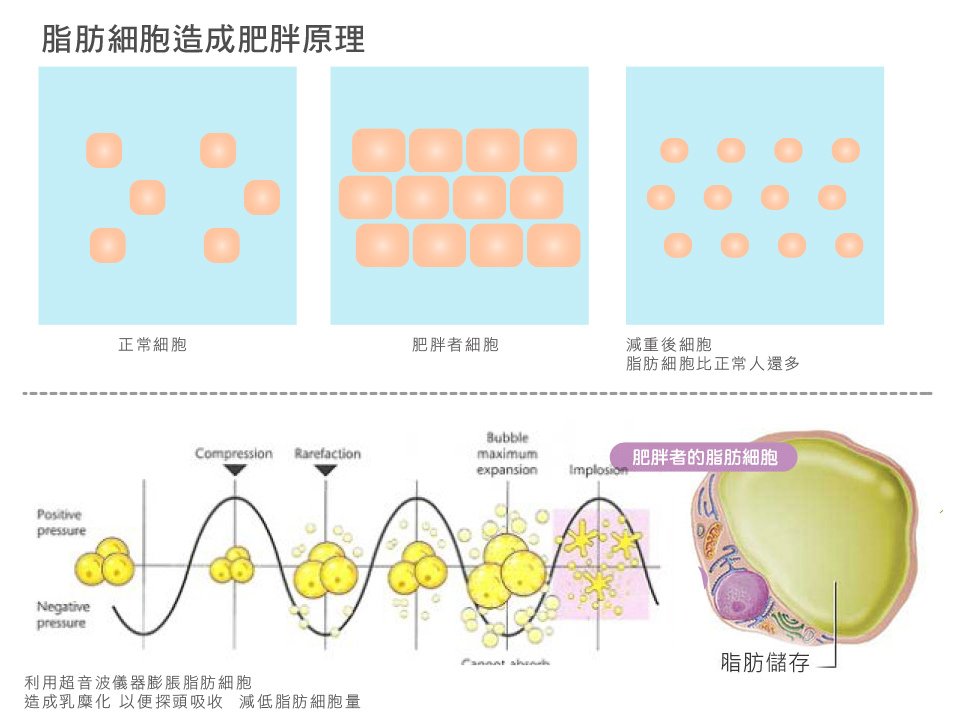 抽脂補脂-4 拷貝.jpg