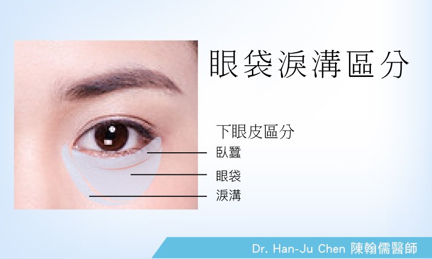 眼皮鬆弛2.jpg