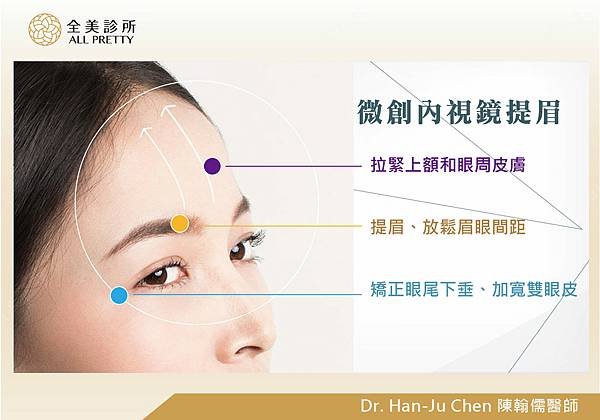 微創內視鏡提眉20200711.jpg