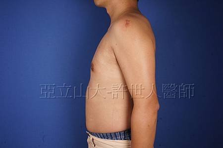 post 5 wks (1)