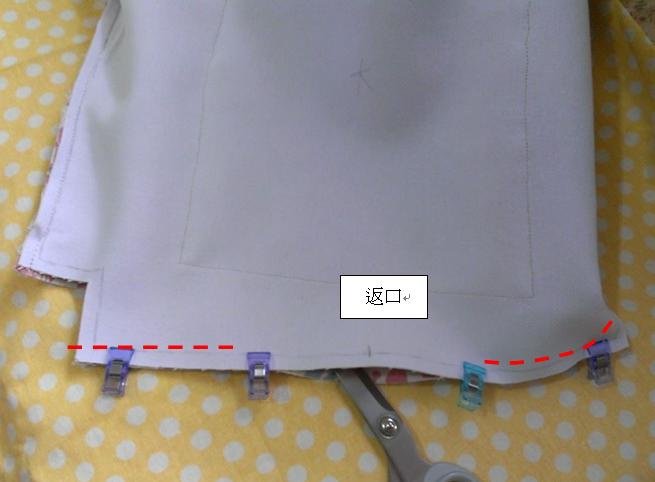 扁支架醫生口金包作法