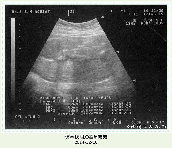 20141208-國泰第四次產檢(16周生長周數都正常, 驗明正身是弟弟)_副本