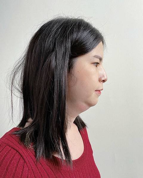 服務體驗 台中 美加健康醫美集團 消脂針 雙下巴 10.jpeg
