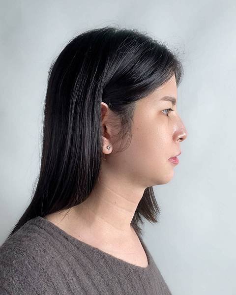 服務體驗 台中 美加健康醫美集團 消脂針 雙下巴 19.jpeg