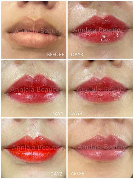 Annlala Beauty 捲捲唇 粉嫩蜜糖唇 修復過程.jpg