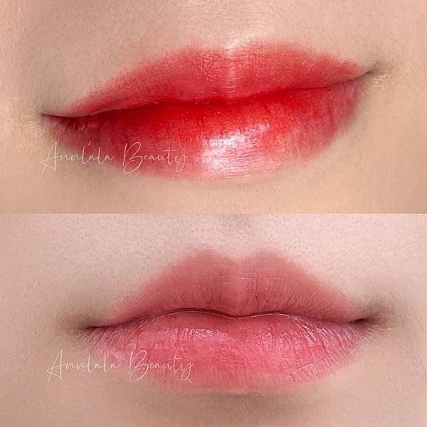 Annlala Beauty 粉嫩蜜糖唇 操作前%26;操作後%26;脫痂後 (3).jpg