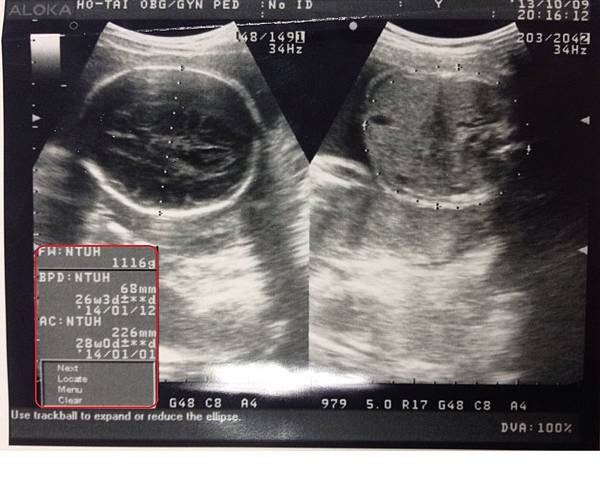 28W